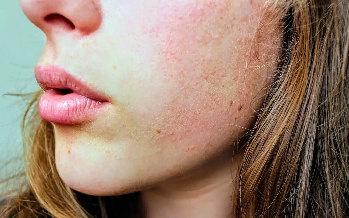 Les ingrédients à éviter dans les produits de beauté pour les peaux sensibles ou acnéiques