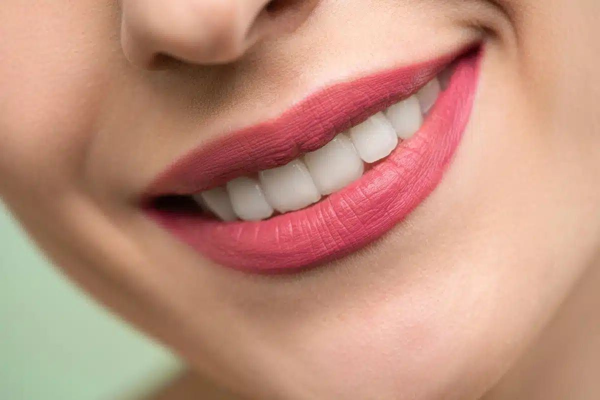Sublimez votre sourire avec ces astuces pour des dents blanches éclatantes