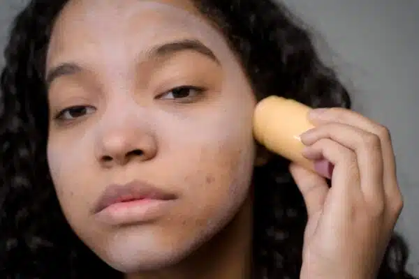 Traiter les problèmes de peau courants : découvrez les produits adaptés pour l’acné, la rosacée, etc