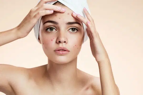 Comment enlever rapidement les boutons des boutons sur le visage ?