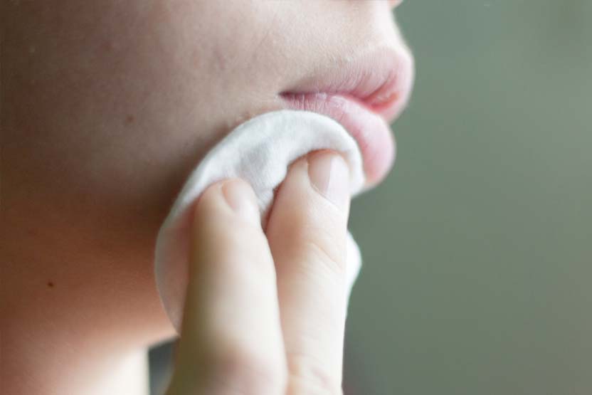 Comment se débarrasser de l’acné rapidement et naturellement ?